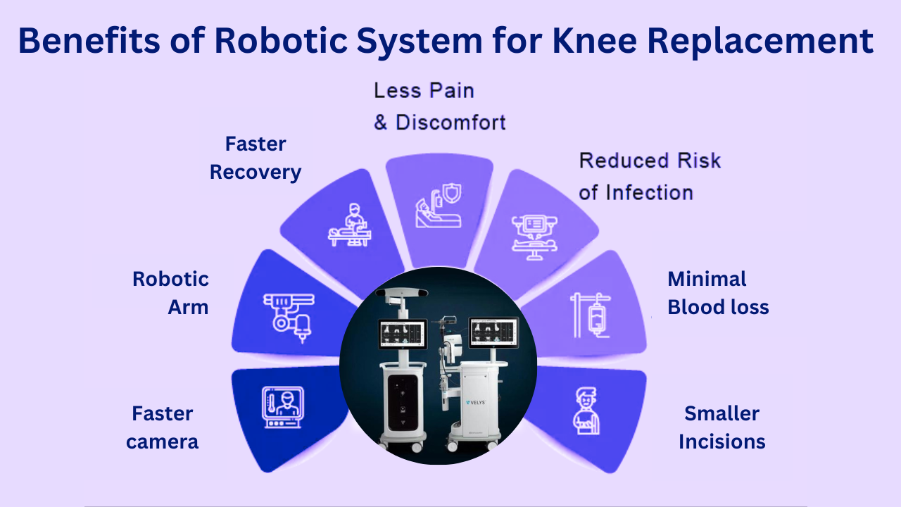 Benefits of Robotic System for Knee Replacement